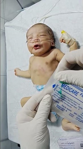 Tachypnea in Newborn | Fast Breathing in Babies Explained #cutebaby #newbornbaby