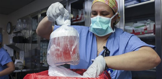 The first pig kidney has been transplanted into a living person. But we’re still a long way from solving organ shortages