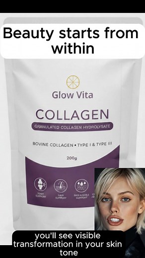 South Africa’s #1 Rated Collagen ✨ Glow Vita™ Collagen is trusted by thousands of women across the country for glowing skin, thicker hair, stronger nails, and a confident glow from within. 🚚 Fast Door-to-Door Delivery — anywhere in South Africa within 2–3 days! 💳 Super Secure Checkout — safe, encrypted payment gateway. 💰 Save Hundreds of Rands with our limited-time bundle specials! Don’t wait — your glow is just one scoop away. 👉 Tap “Shop Now” to order your Glow Vita™ Collagen today! ⭐️⭐️⭐️