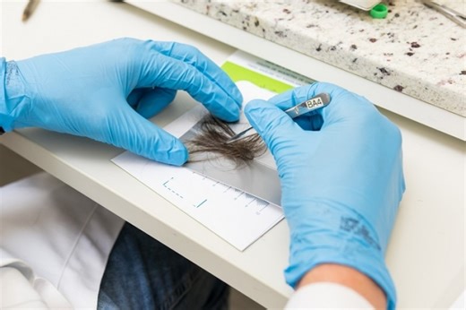 Como o cabelo se tornou prova científica na toxicologia forense - Estradas