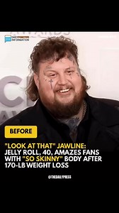 19K views | After shedding 170 pounds, Jelly Roll’s transformed jawline has fans in total shock. The before-and-after pictures are unbelievable  (check in the first comment) | E̶l̶e̶g̶a̶n̶t̶ | Facebook