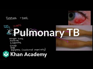 Tuberculosis - Pulmonary Disease Video Lecture - MBBS