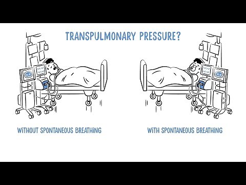 Transpulmonary Pressure Monitoring by Dräger