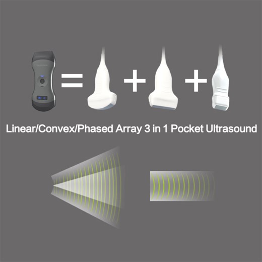 EagleView Portable Wireless Ultrasound Probe ☑️ One machine, for whole body. No need to waste time on replacing probes. Built-in hybrid system(linear, convex, phased array) ☑️ B-mode, M-mode, Color Doppler, Power Doppler, and Pulsed Wave Doppler. ☑️ Imaging data is saved on your mobile devices. No need to pay for cloud storage in the future. ☑️ No reliance on the hospital or clinic network with a built-in WIFI hotspot ☑️ Easy, AI-powered App for iOS and Android ➡️ Buy now🔗https://geteagleview.c
