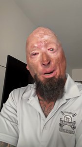 66K views · 5.7K reactions | Combat Veteran Rico Brown needs our support with love, prayers ￼￼& financial support ￼anything you can help with would be much appreciated. ￼ https://www.mealtrain.com/trains/y54v6l?fbclid=IwQ0xDSwLvVRtleHRuA2FlbQIxMQABHj8eeYMwI-TL8ygExMr0CcrrsKusbpJYzCTa8d9tORO2I7IDg9bPvw7l6q1A_aem_zDfbZWoUcdr3AZNI9q5NzQ | Bobby Henline | Facebook