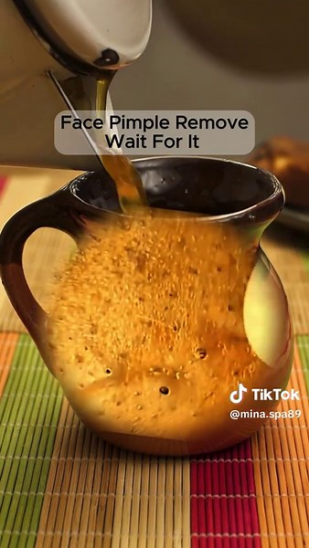 Satisfying Pimple Extractions and Relaxation Techniques