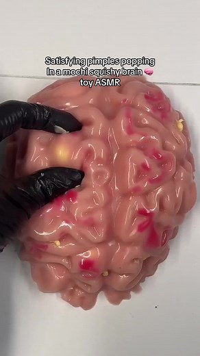 Satisfying Pimple Popping in Mochi Squishy Brain Toy ASMR
