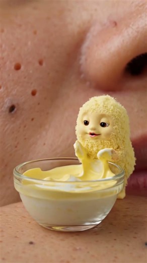 Bye Bye Blackheads 👋 The Cutest Natural Remedy! (Besan + Curd)#bytevionverse #shorts #skincare