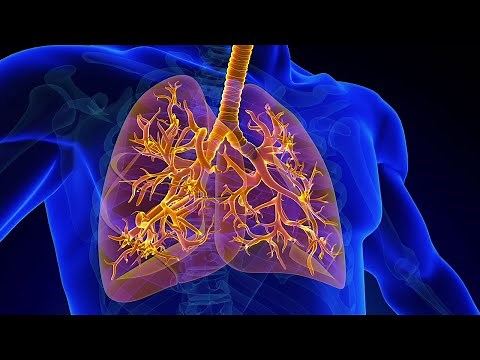 Treatment for Tracheobronchomalacia (TBM)