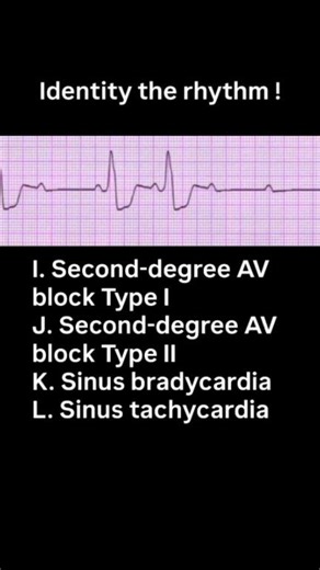 #ecgchallenge ECG Challenge 💪💪💪 | House of Medical Skills and Knowledge with Dr IsraelGi