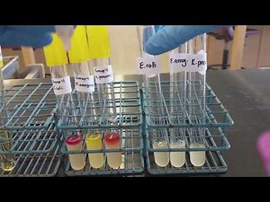 Biochemical Tests - MR-VP Test