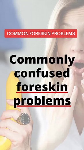 Common tight foreskin problems (Phimosis and Paraphimosis) #phimosisbaby #phimosissurgery #circumcised #circumcisedvsuncircumcised #circumcisedgang #uncircumcisedboy #circumcisedbaby #uncircumcisedmen