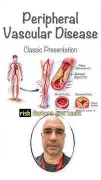 Don’t miss this classic presentation of this dangerous cardiac diagnosis ❤️❤️