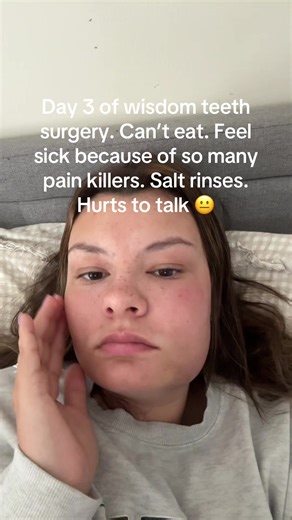 Wisdom Teeth Recovery: My Day 3 Experience