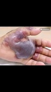 ATTENTION to these first signs of...See More | Talent Show