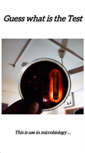 Starch Hydrolysis Test | Amylase Activity in Bacteria