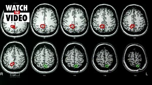 ‘Crying?’: Teo’s alleged words to dying patient