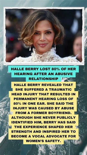 Halle Berry Lost 80% of Her Hearing After an Abusive Relationship