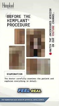 Real Size Gains with Himplant® Penile Enlargement | Before & After Result