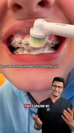 Dentite on Instagram: "🦷 ORAL HYGIENE ROUTINE WITH BRACES 🪥✨ Braces straighten teeth… but only YOU keep them healthy 👀👇 Having brackets + wires means more plaque traps, so your home care has to level up ⬆️ 🔹 1️⃣ Brush after every meal 🪥 Use a soft-bristle toothbrush or electric brush ➡️ Angle the bristles 45° above & below the brackets ⏱️ Take your time — rushing = missed plaque 🔹 2️⃣ Use an interdental brush DAILY 🧹 This is non-negotiable ✔️ Cleans between brackets & under wires ✔️ Prev