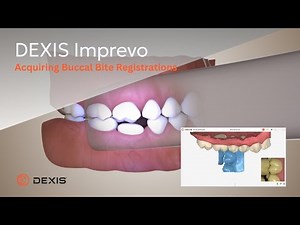 DEXIS™ Imprevo - Acquiring Buccal Bite Registrations