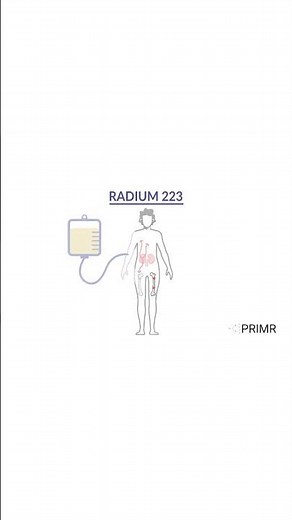 Radium 223 and Its Effect on Cancer in Bones