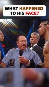 What Did He Do to His Face? 😳