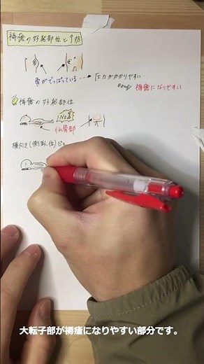 褥瘡の好発部位と予防 #勉強 #介護福祉士