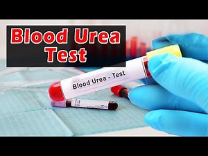 Serum Urea Test | Blood Urea Test Procedure | Blood Urea Test | Blood Urea Estimation