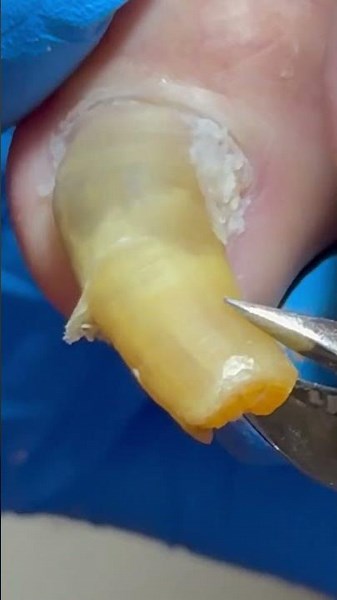 Satisfying Pedicure Video! #pedicure #toenails