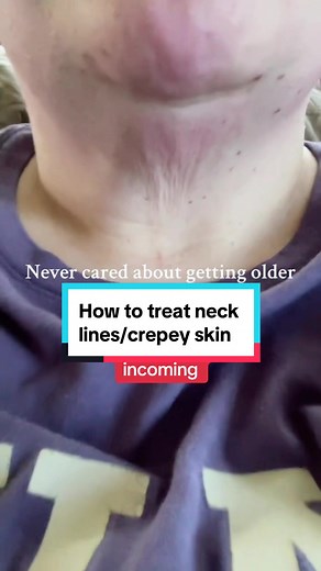 Effective Ways to Treat Crepey Neck Skin and Neck Lines
