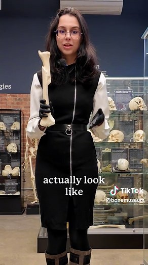 Understanding Lindsey Vonn's Tibial Fracture