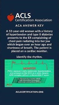 ACLS Megacode 4 Q1 Answer Key #aclsmegacode #acls #reels