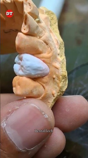 premolar anatomy| how to Porcelain ceramic| how to make teeth| dental video| dentist| dental tech