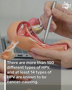 Promising results from an HPV study! | IFLScience