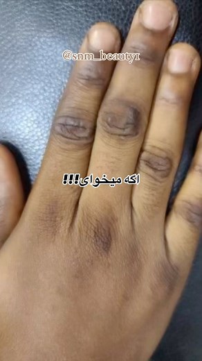 ‎✨ صنم بیوتی|حجم دهنده سینه+ خداحافظ تیرگی!👋🏻 🌸‎ on Instagram‎: "قرص گلوتاتیون✅✅ سفید کننده دائمی پوست🔴🔴 این قرص خاصیت آنتی اکسیدانی قوی داشته و علاوه بر اینکه از پیری پوست جلوگیری می‌کند، باعث حذف لک‌های پوستی نیز می‌شود جهت مشاوره رایگان👇🏻✅ @snm_beauty1 جهت ثبت سفارش🔴👇🏻 @snm_beauty1 @snm_beauty1"‎