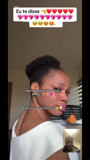 #tratamentocapilar #Crescimentocapilar #cabelocrespo #foryoupage❤️❤️ Partilhar!!