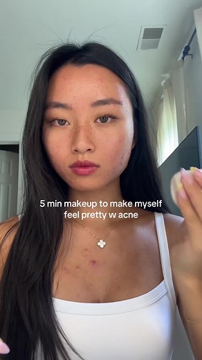 5-Minute Makeup for Acne-Prone Skin