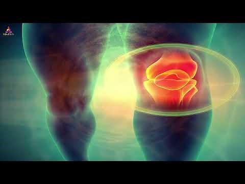 Knee, Joint Pain Relief - Miracle Rife Healing Frequency | Pure Binaural Beats Sound Healing Therapy