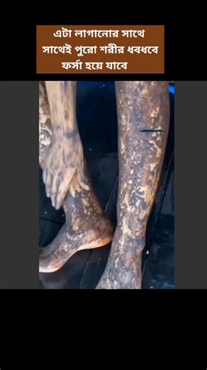 শরীর ফর্সা করার দোয়া ও পদ্ধতি