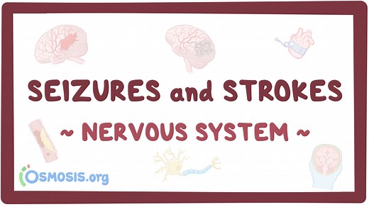 Nervous system: Seizures and strokes: Video, Causes, & Meaning | Osmosis