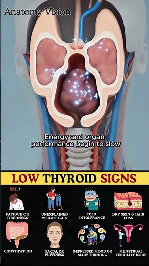 Top Doctor Reveals 8 Hidden Signs of Hypothyroidism