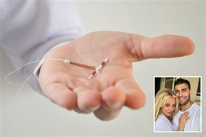 What is an IUD and how does the coil work?