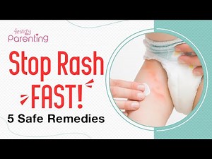 5 Safe Baby Diaper Rash Home Remedies | How To Treat Diaper Rash In Babies Naturally