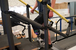 Mind-controlled bionic leg enables amputees to move more smoothly and naturally