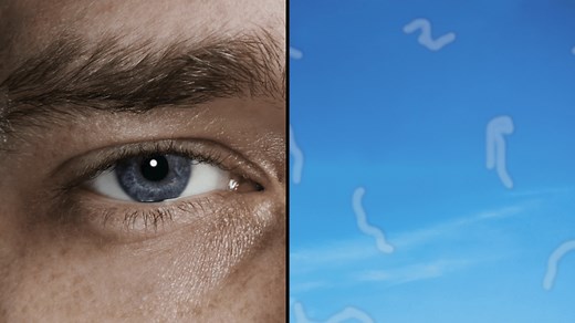 NHS advice on medical help if you see 'squiggly lines', floaters or flashes in your eyes