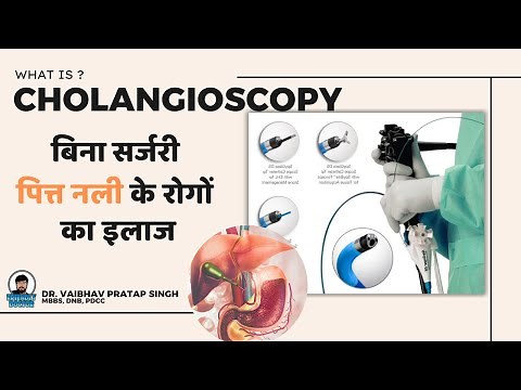 What is Cholangioscopy? | Complete Bile Duct Examination & Treatment