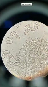 Enterobius vermicularis (Scotch test)