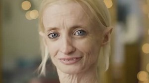 Oldest survivor of 'Benjamin Button' condition shares her story