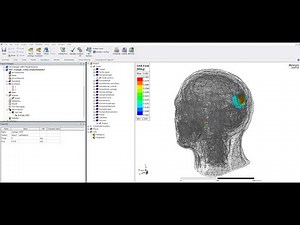 Wireless Power Transfer and SAR Simulation of Implantable Medical Devices Using Ansys HFSS